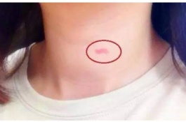 如何种植草莓籽，处理草莓籽